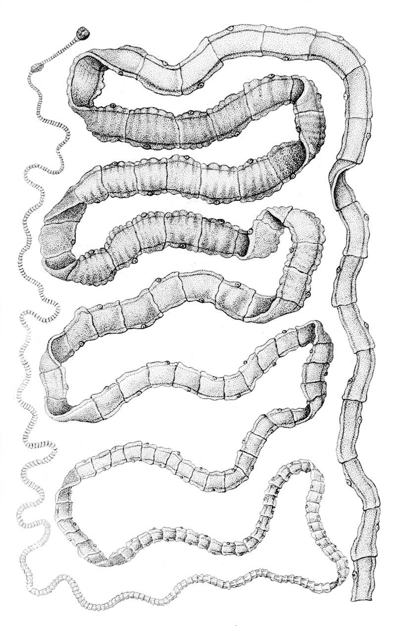 Illustration for article titled Acude al hospital con dolor de cabeza y le encuentran una plaga de gusanos en el cerebro